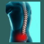 Acute Sacroiliac Pain - Sacroiliac Joint Pain